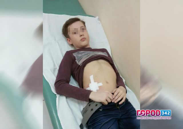 В Перми во время дорожной разборки был ранен школьник