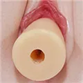 Austauschbare Vagina