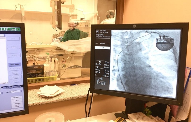 В Березниках пациентам ставят кардиостимуляторы. В планах на 2018 год – 100 таких операций