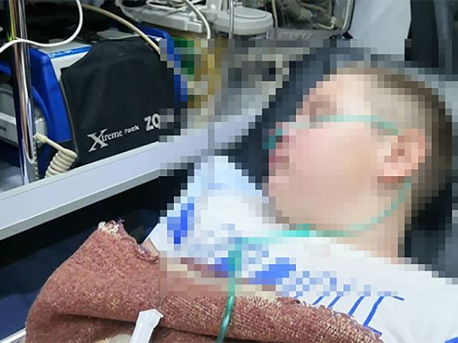 11-летний школьник получил серьезные травмы после ДТП в центре Перми
