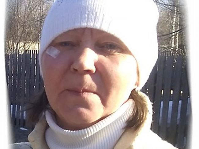 В Пермском крае разыскивают женщину со шрамом на лице
