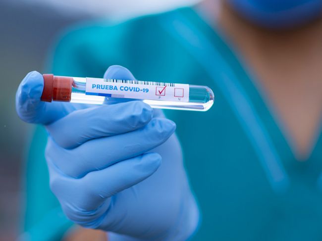 Ученые изменили прогноз по окончанию эпидемии коронавируса в России