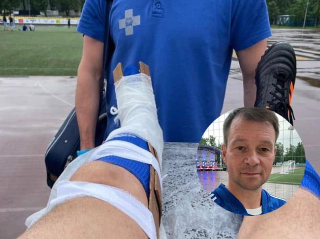 Врио председателя Пермской гордумы сломал ногу на футбольном турнире